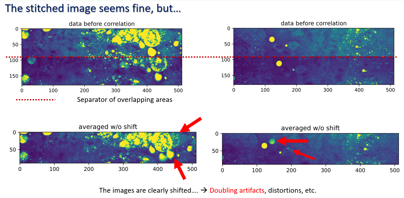 Two examples on different overlap regions of the same CARS liver dataset. Top row: the overlap regions before correlation, with a red dashed line marking the seam between the two tiles. Bottom row: the same regions after averaging without shift correction. Red arrows mark doubling artefacts and ghosted lipid droplets that the wide stitched image hides