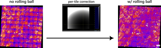 Tuned rolling-ball stitched liver result